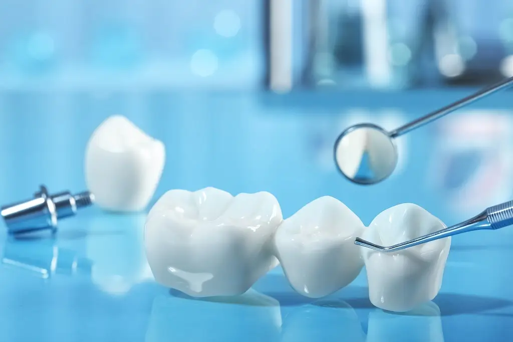 Dental Bridges Care Dental Bridges Care