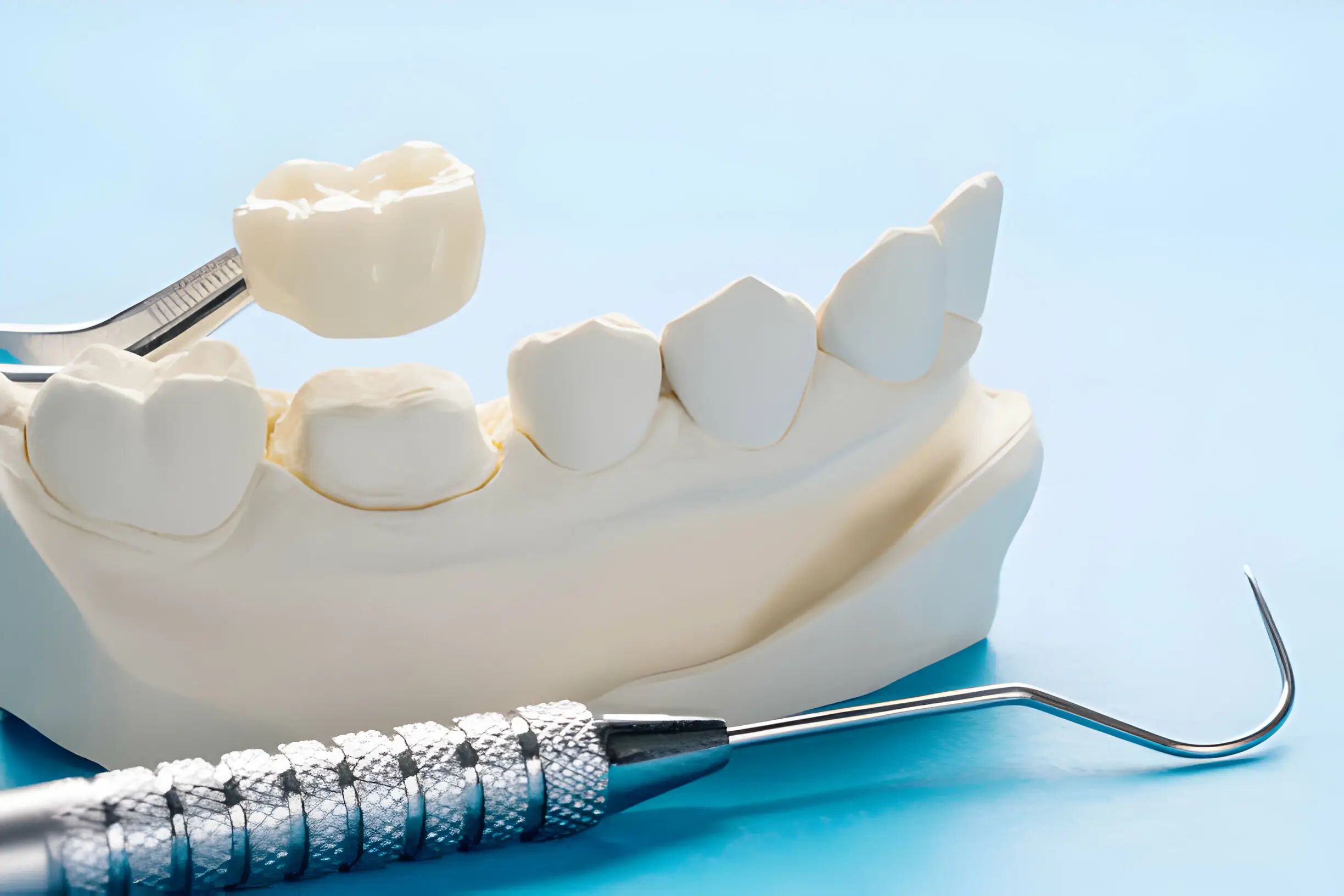 Dental Crowns