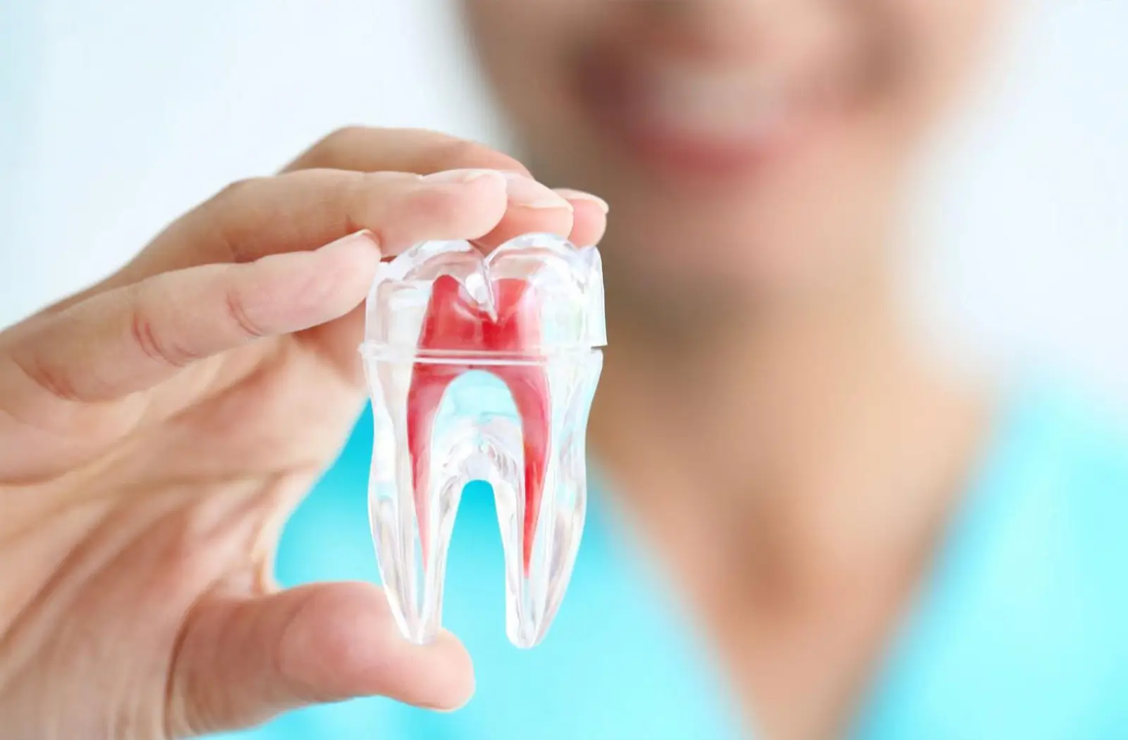Root Canals