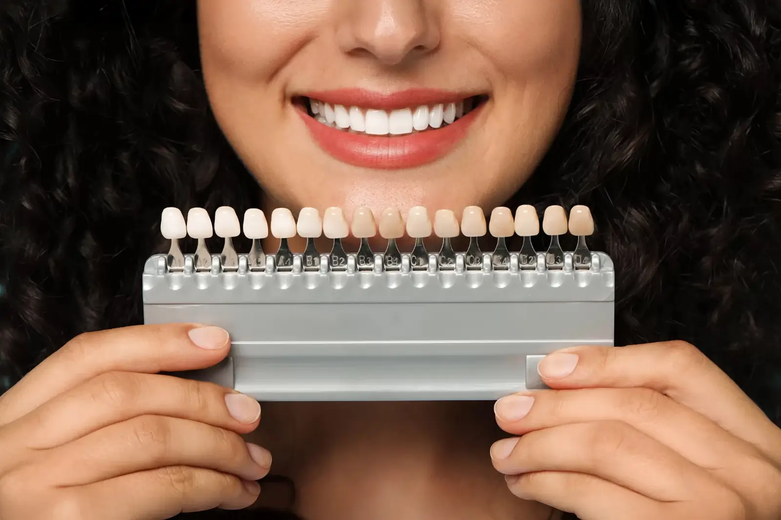 Veneers