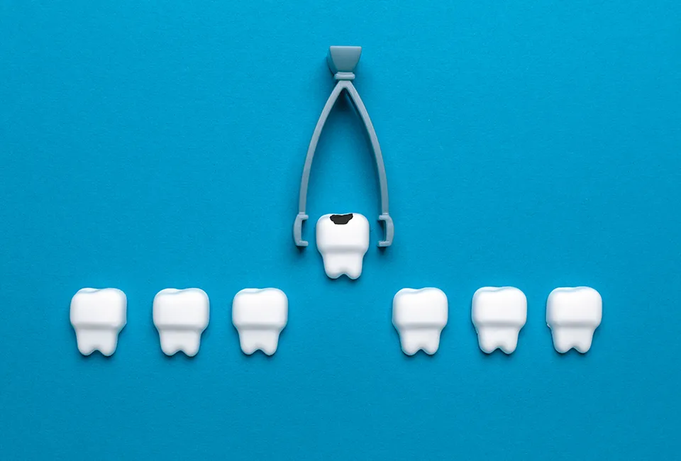 tooth-extraction-dentist